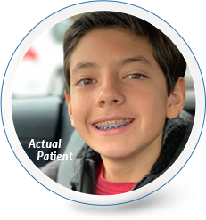 delurgio blom orthodontics braces for children