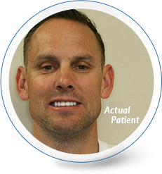 delurgio blom orthodontics invisalign for adults