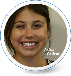 delurgio blom orthodontics smile gallery