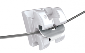 in ovation c ceramic bracket orthodontic braces