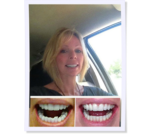 orthodontist for adult braces in fair oaks ca
